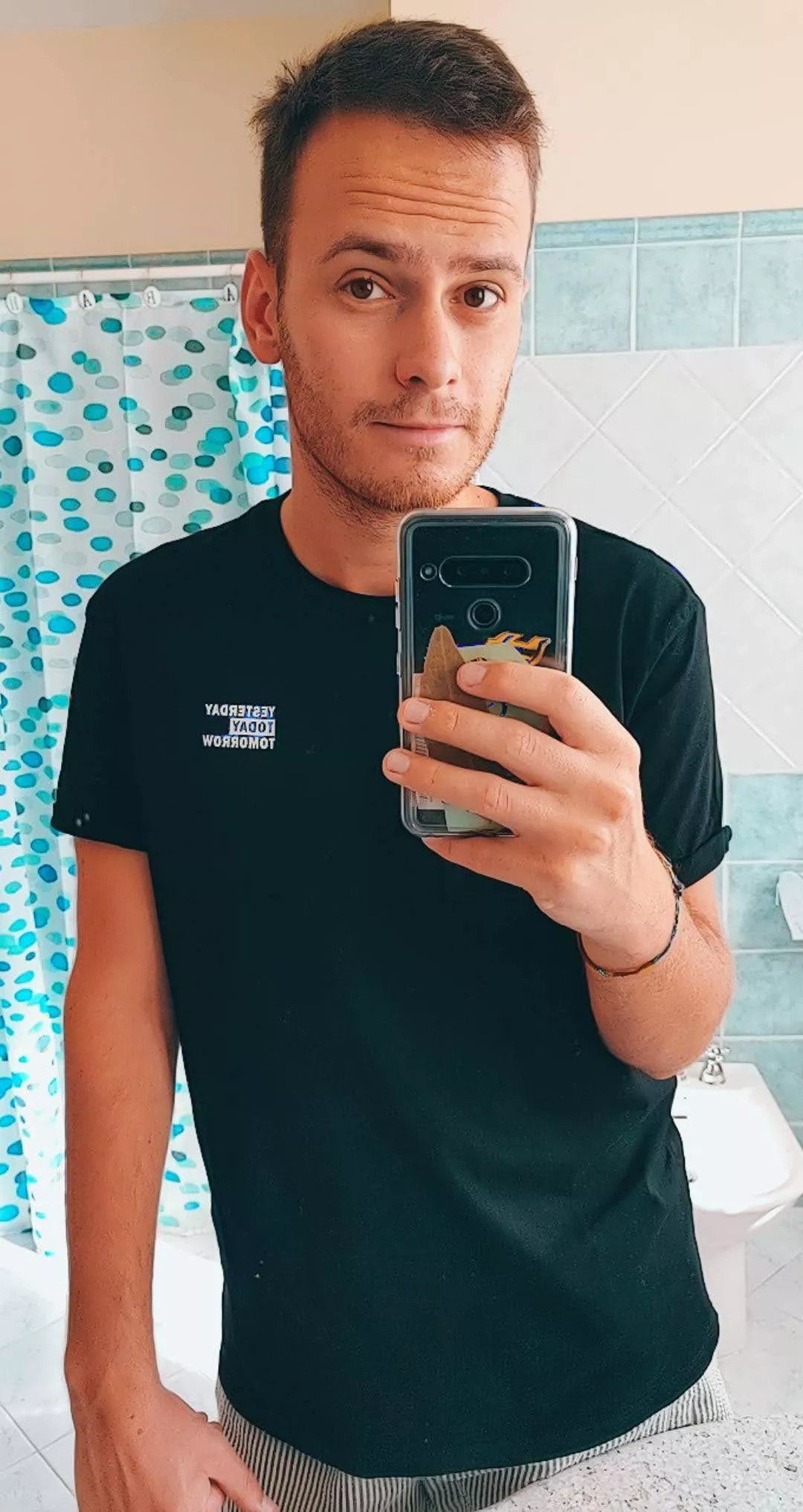 Hi! I posted this photo of me w/ my full face a while back on my old account, but ended up deleting the whole thing during a bad moment 'cause I was ashamed. But then I realized that I really shouldn't... So here I am, with a new account, trying again 