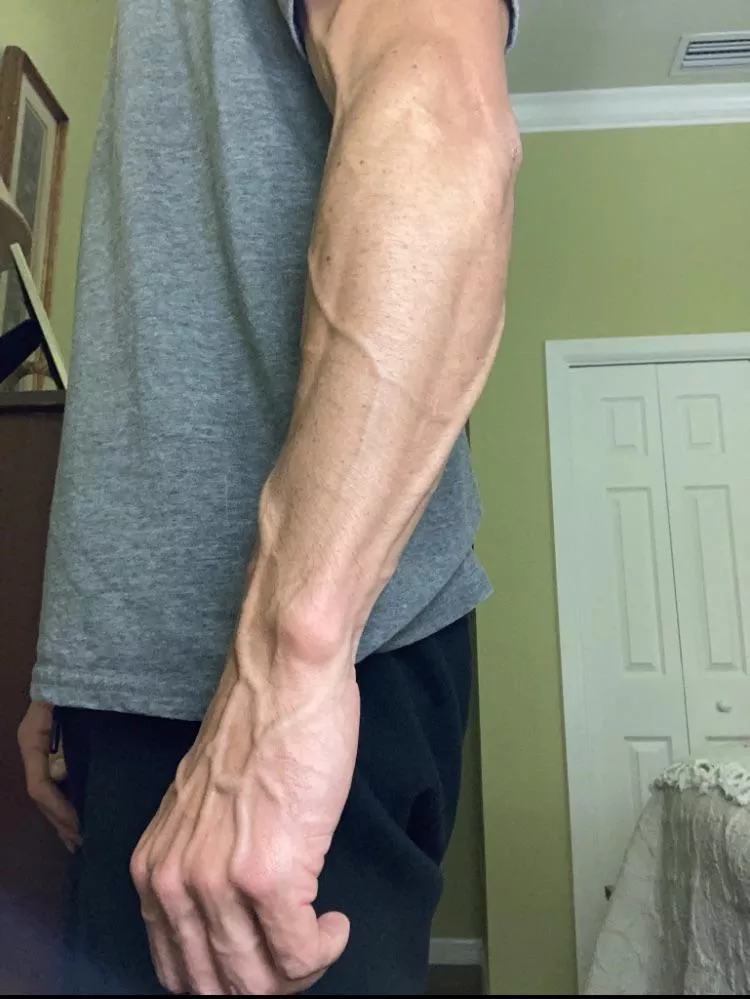 Hop on the vein train. WOoooO woooOooo!