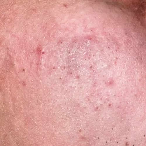 husband doesn't let me pop them