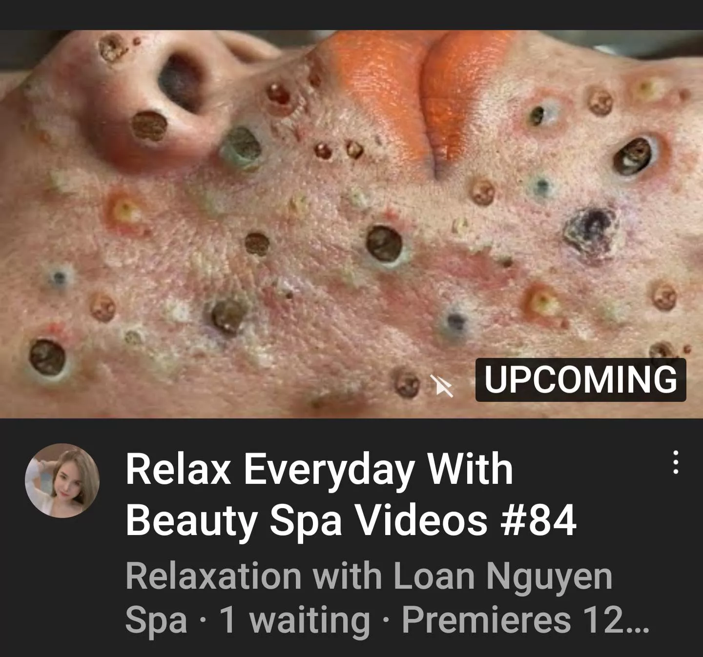 I can't relax everyday with these thumbnail pics