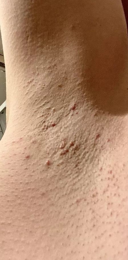 I destroyed it with shaving lol