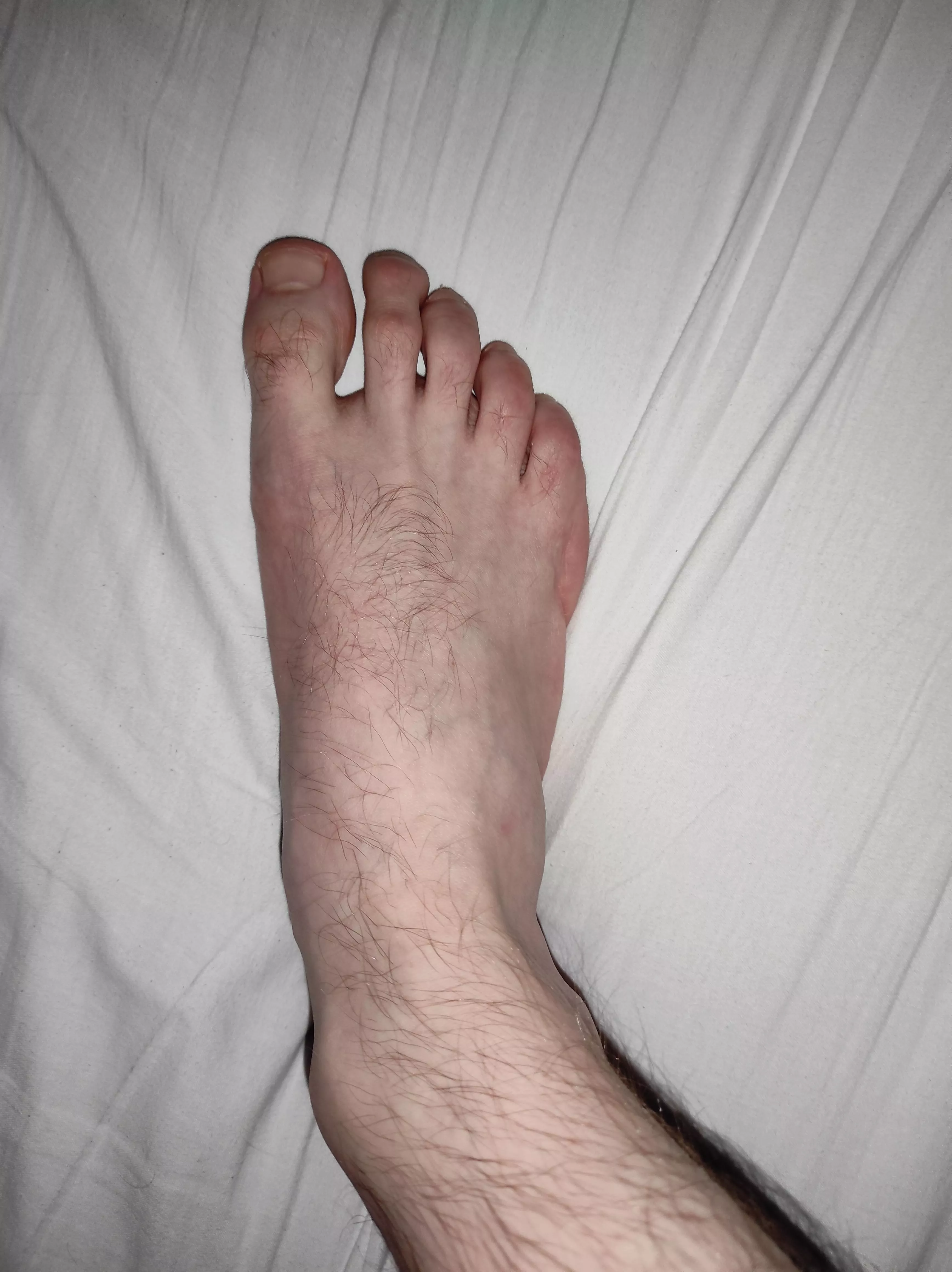 I don't like the tops of my feet, but I thought i should show it anyway