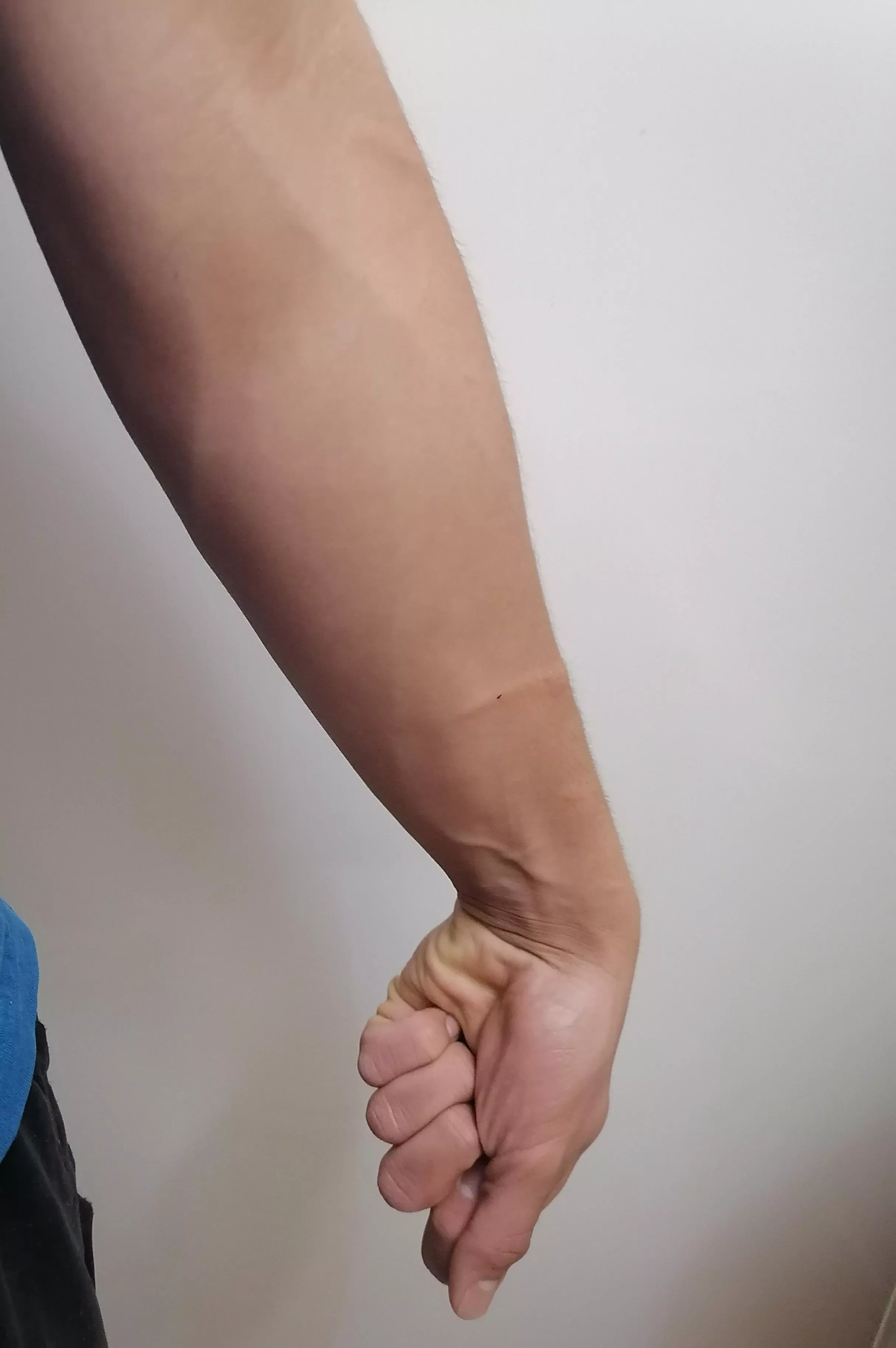 I feel like I'm lacking more scratches but I'm willing to get a second opinion