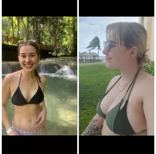 i had a breast reduction, then having a baby gave me my boobies back😆
