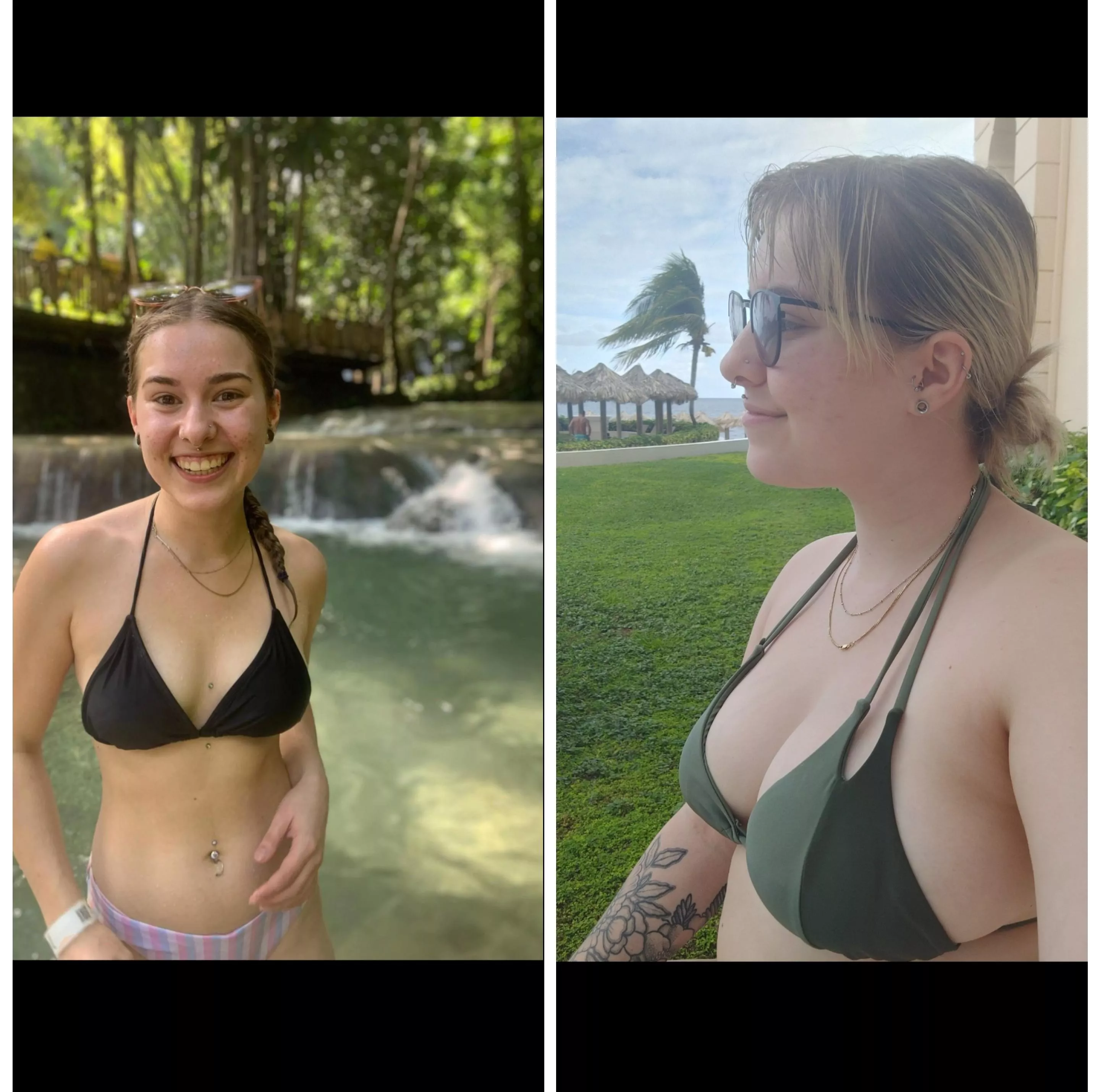 i had a breast reduction, then having a baby gave me my boobies back😆 i had a breast reduction, then having a baby gave me my boobies back😆