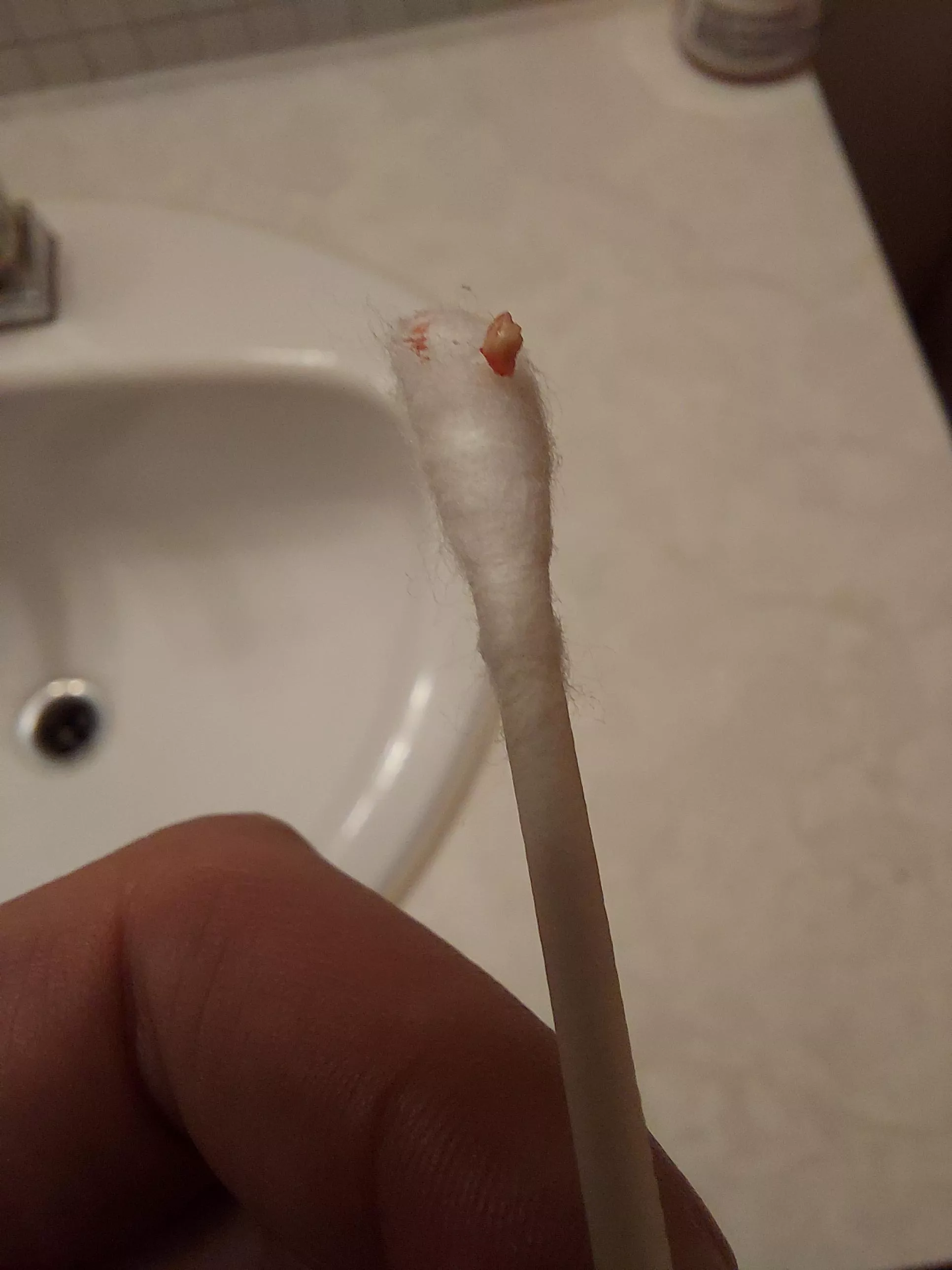 I had a sore bump in my ear all week and this popped out along with some grey slime. Felt better afterwards though