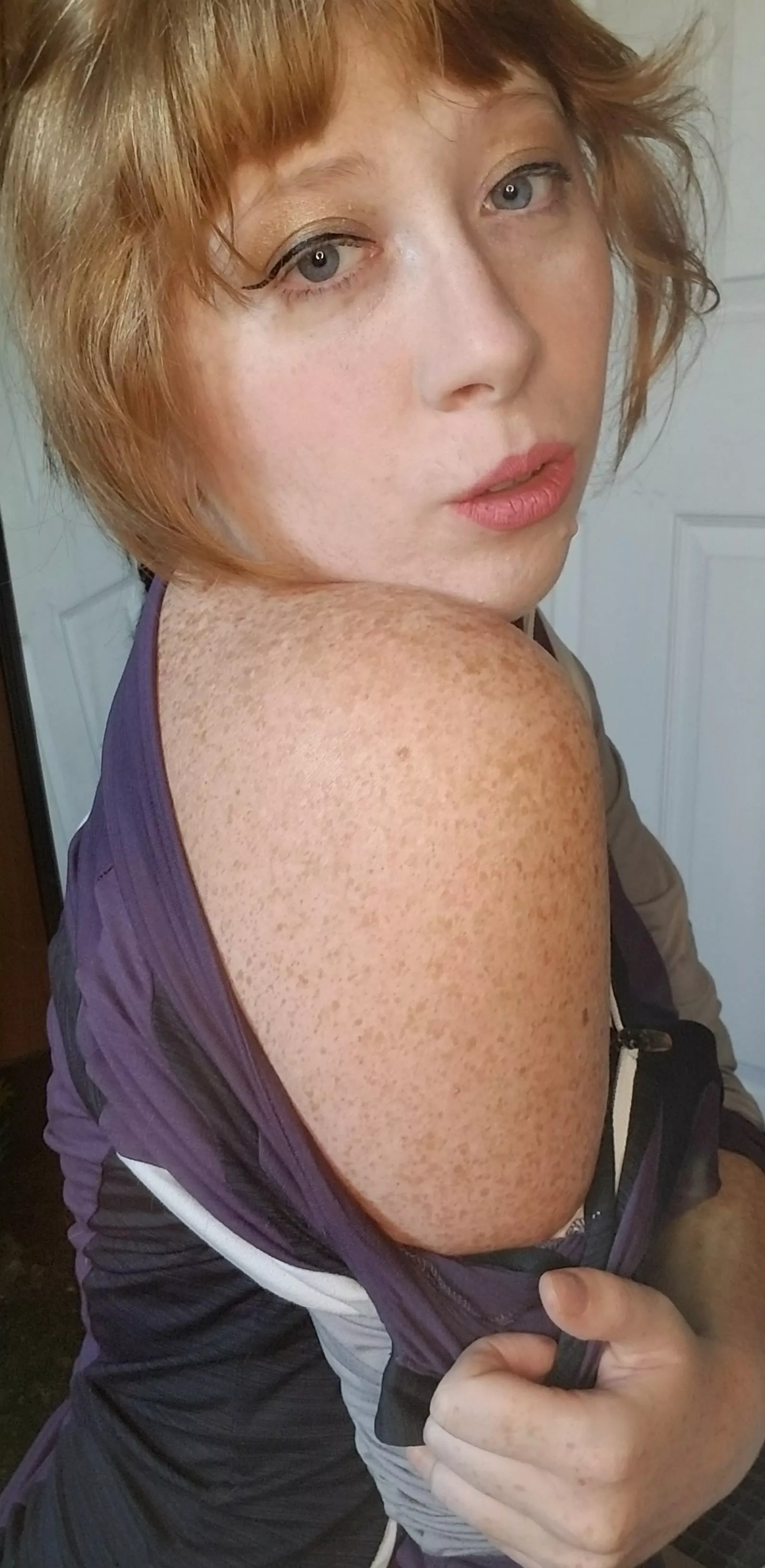 I have so many freckles rn I have so many freckles rn