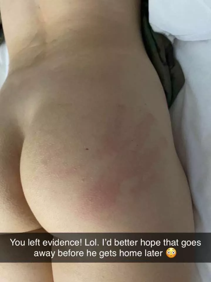 I hope that doesn’t leave a mark I hope that doesn’t leave a mark