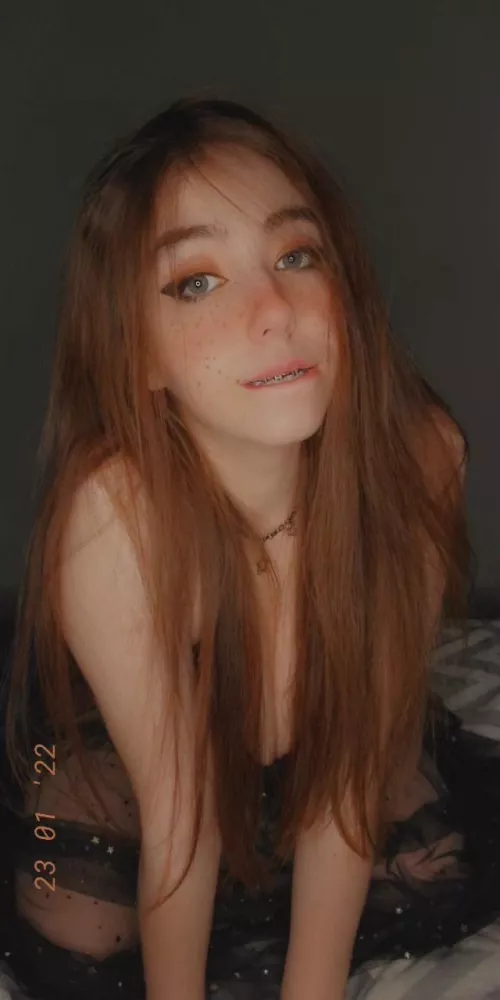 I hope you guys are having a fantastic Tuesday about to play some league but enjoy a decent braces pic 🙃🙂