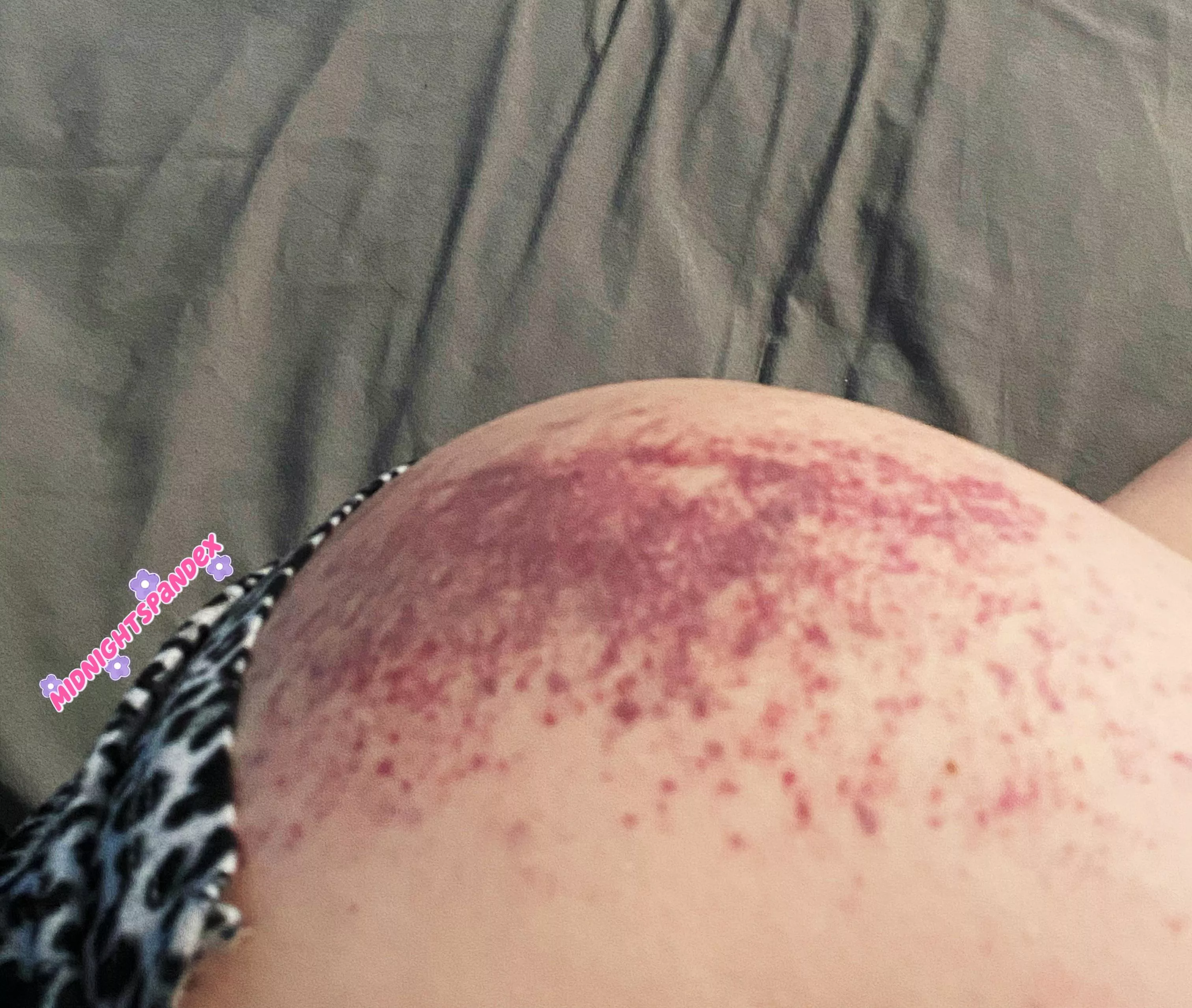 🙈💕I just kept asking my Dom for more (spanking aftermath), 25F
