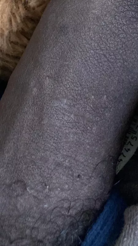 I just want to know if Iβm ok why is my dick so black do that mean anything