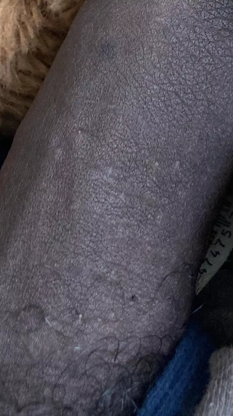 I just want to know if I’m ok why is my dick so black do that mean anything