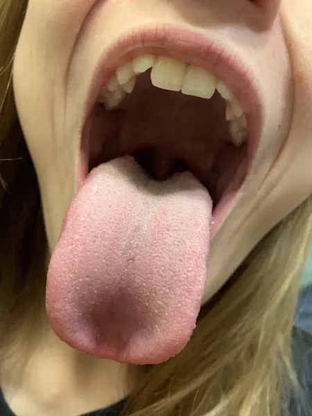 I love my mouth π₯΅