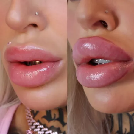 I love transforming into a plastic Bimbo f*ck doll! DSL progress - we did 3ml top up 💉💕