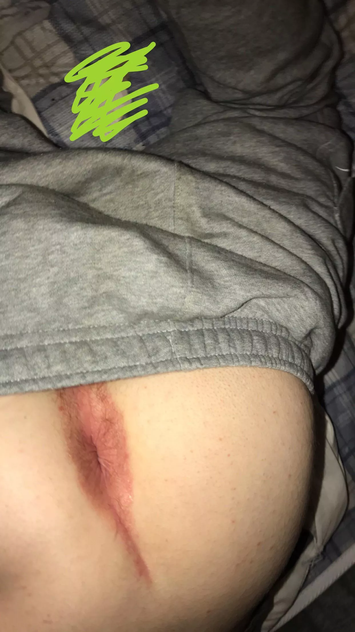 I need my hole soo much bigger dm me 😈 I need my hole soo much bigger dm me 😈