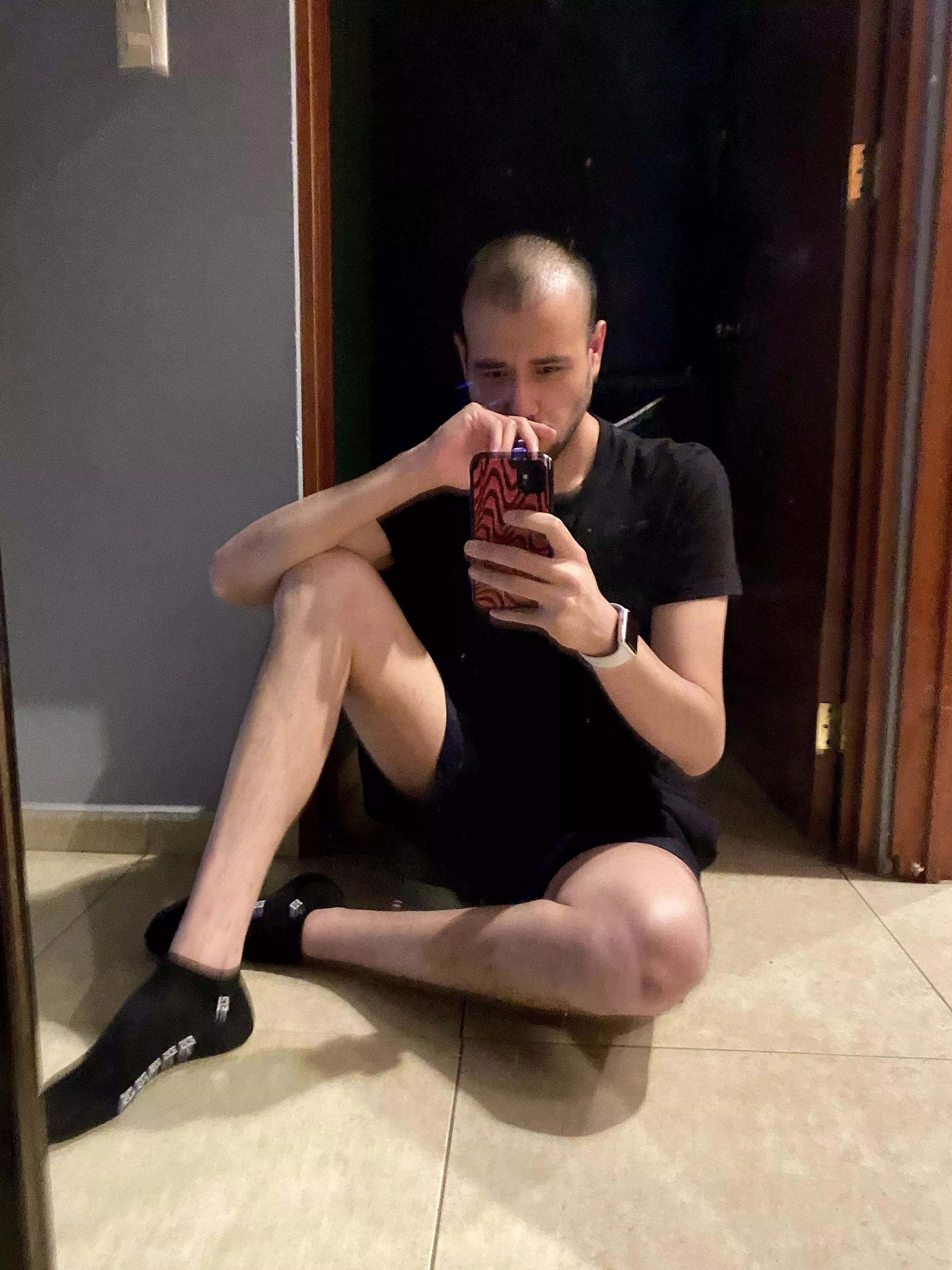 i recently got a hair transplant and i was scared to post pictures… but i’m trying to let my fears go and post pictures!