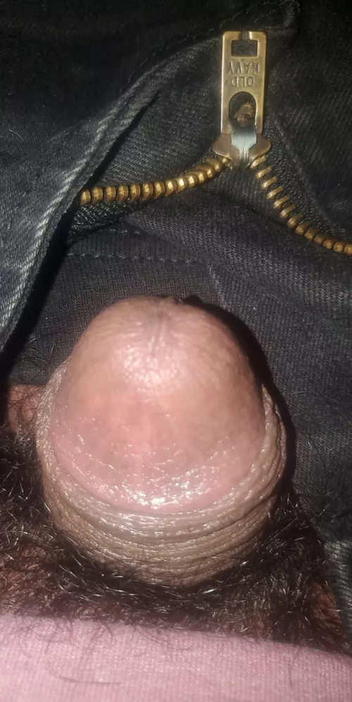 I think I have a tiny dick [21]