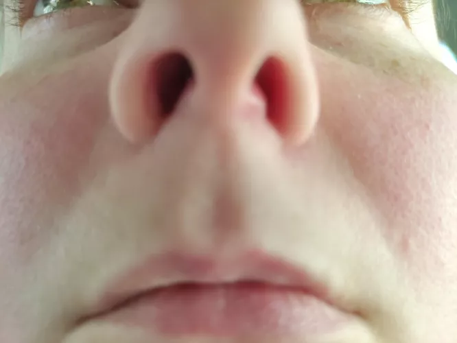 I think I'm getting a pimple in my nose. I've already tried to pop it 78 times. Send help! (Feel free to downvote, I know pics just aren't the same haha)