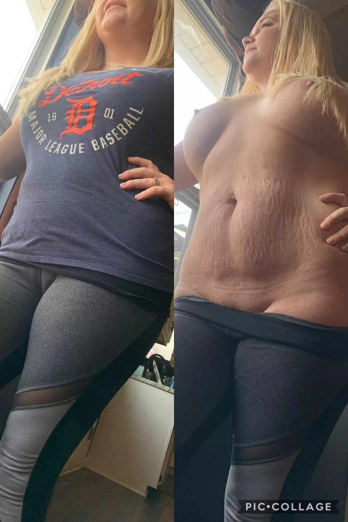 I think off is better, but I’ll let you decide 😊 [33F]