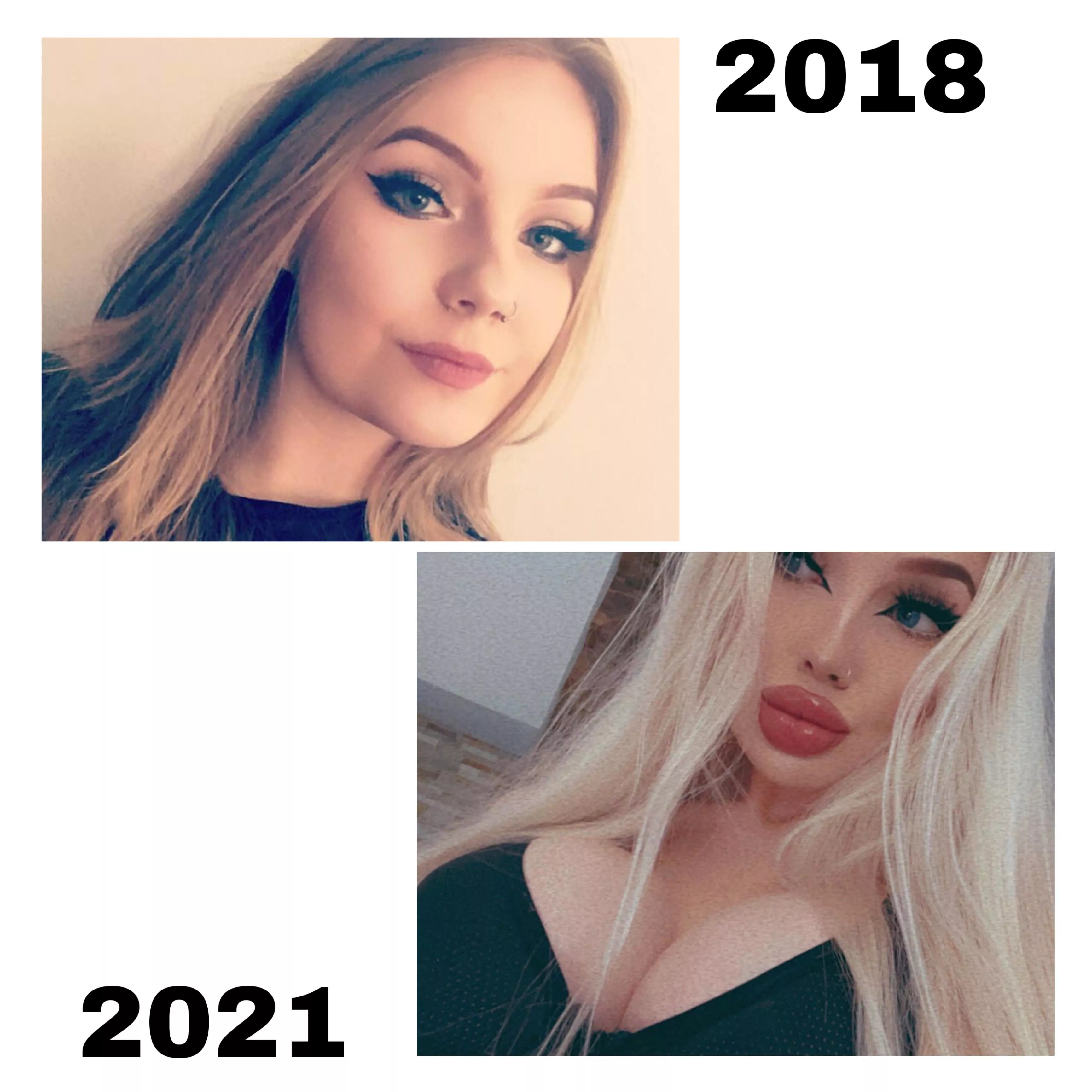 i think that my bimbofication is unbelievable🤯😈💋 i love my fake boobs and lips💋 i think that my bimbofication is unbelievable🤯😈💋 i love my fake boobs and lips💋