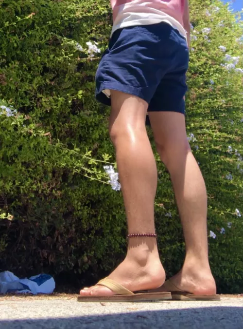 If you saw me in public would you stare?