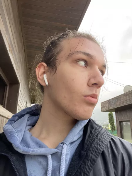 Iโm really insecure abt my face but i wanted to share