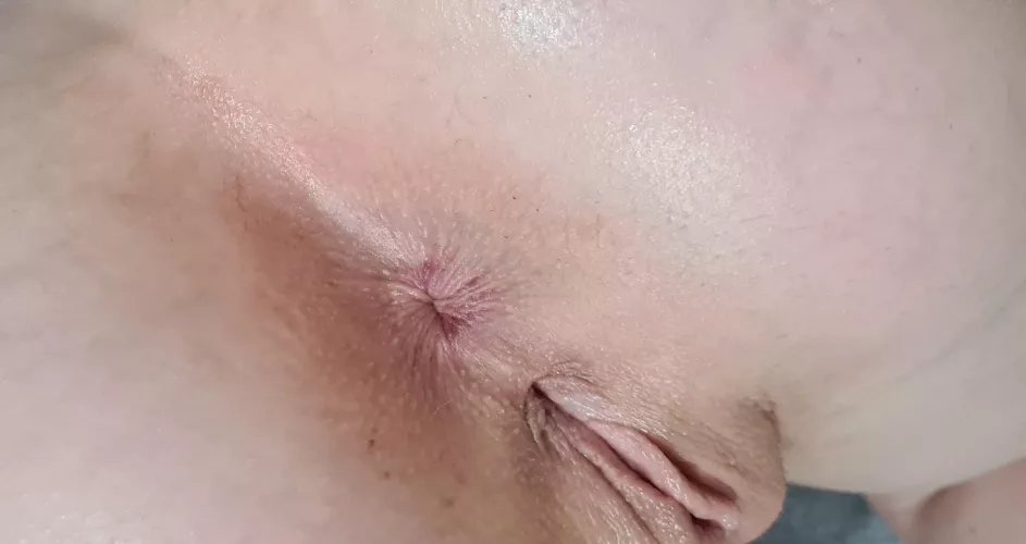 I'm starting to love my outie after hating it for years