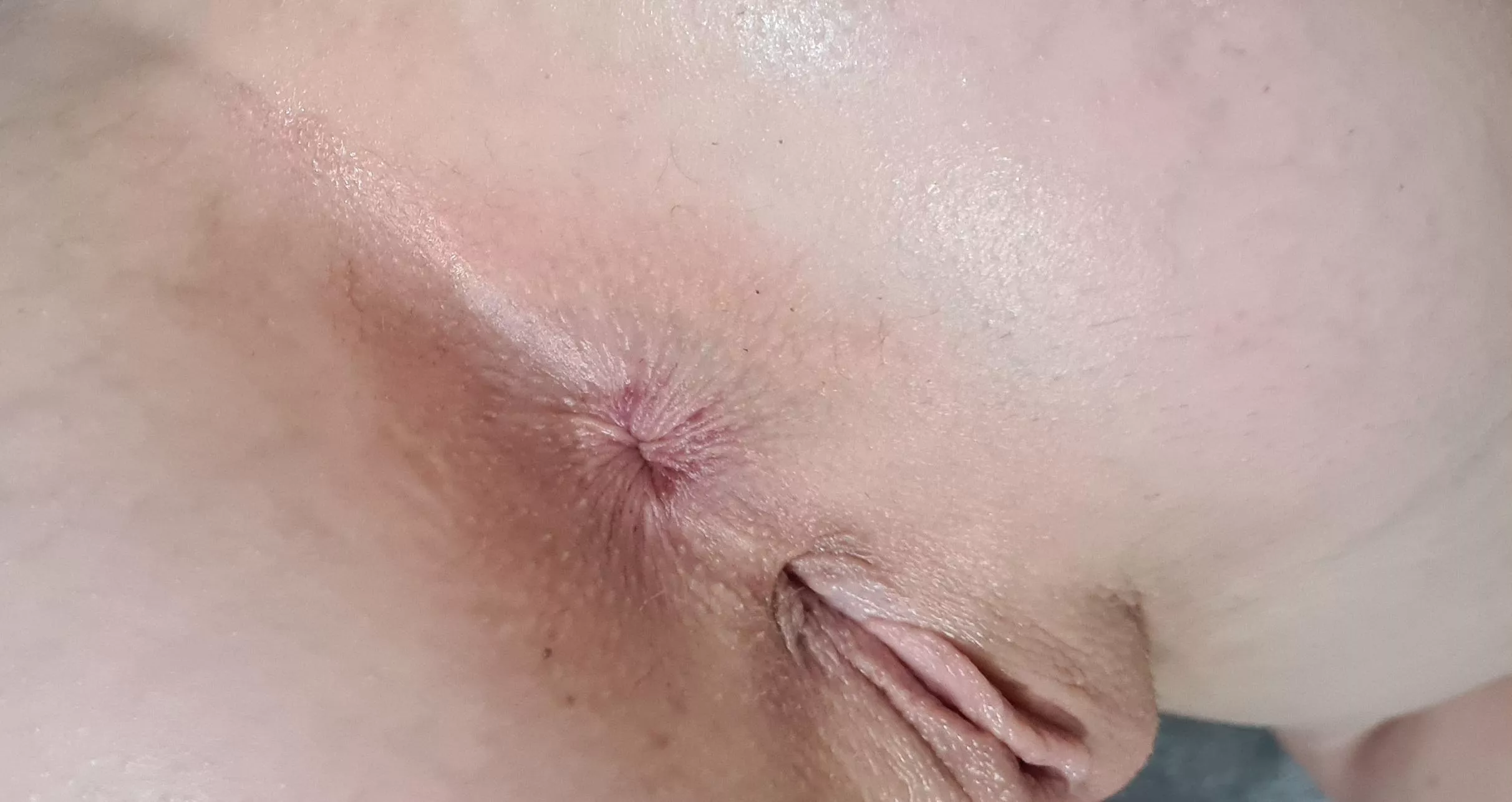 I'm starting to love my outie after hating it for years