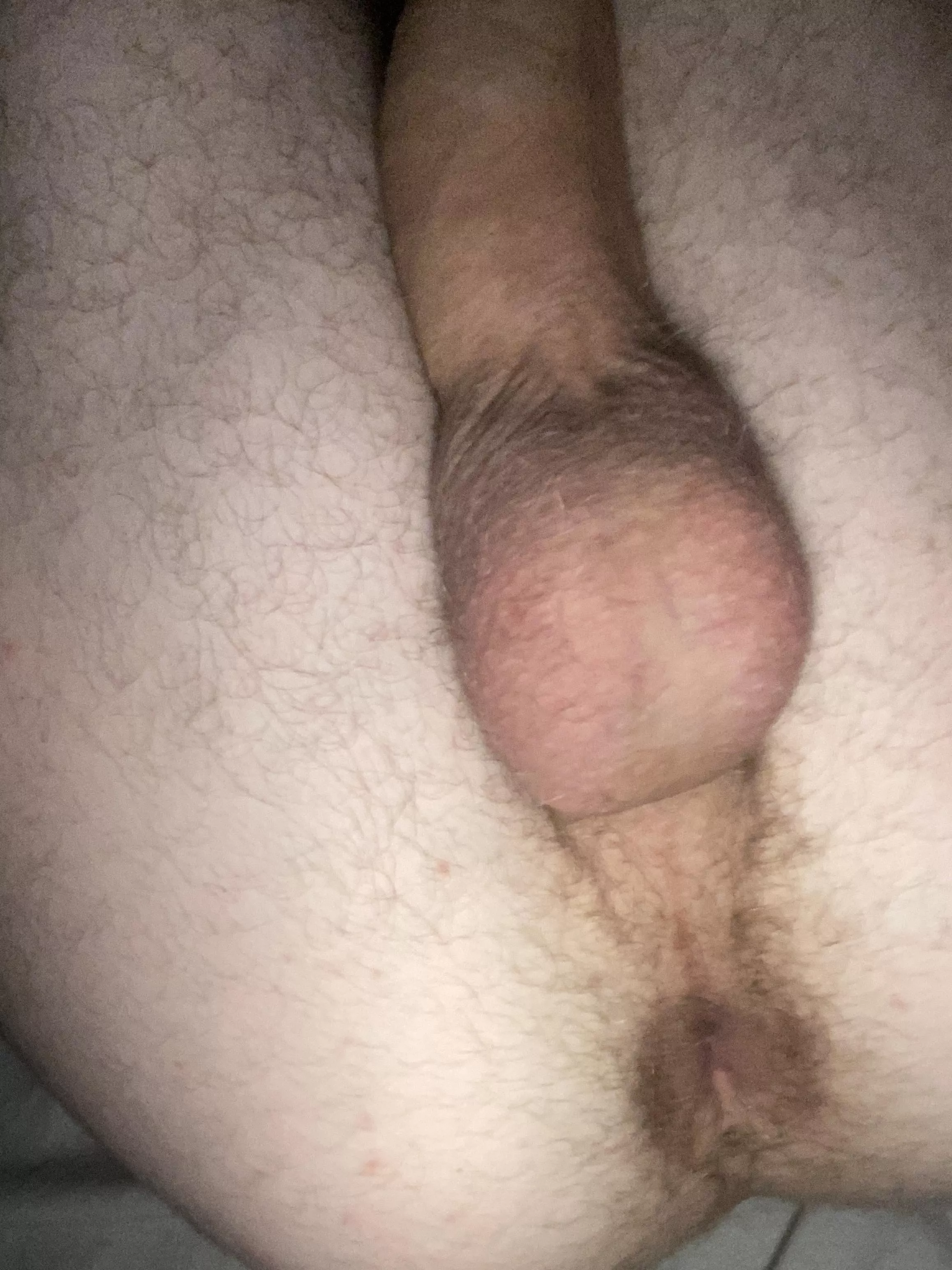 Is a tiny bit of hair welcome here ? 🥴 Is a tiny bit of hair welcome here ? 🥴