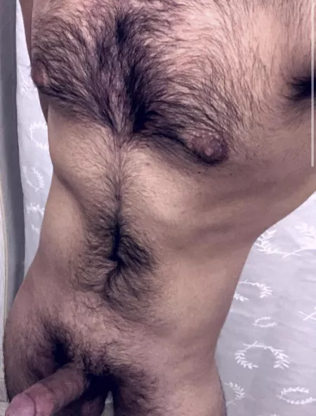 Is this considered extremely hairy??