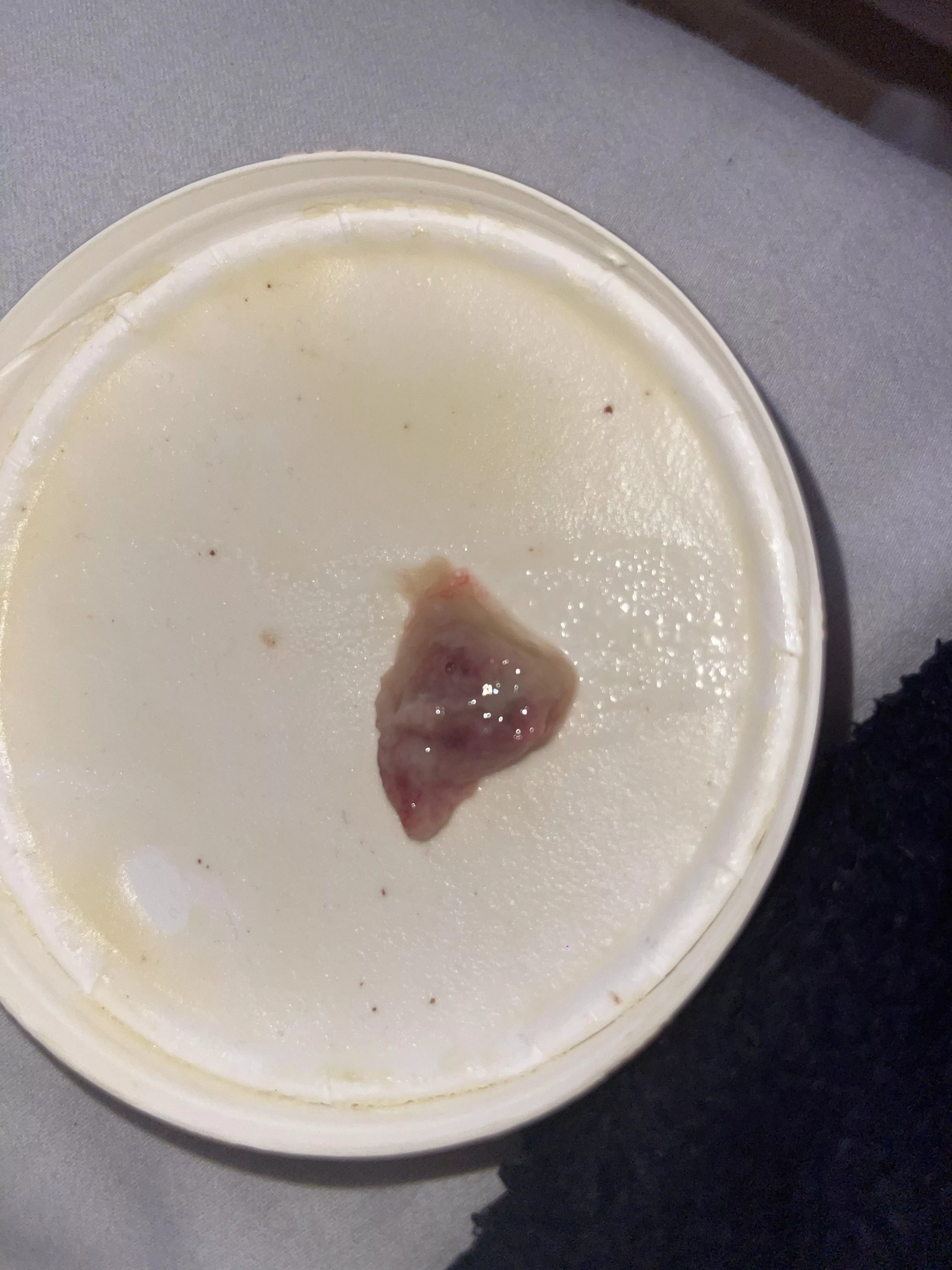 just coughed this up, have a horrible throat & sinus infection, haven’t been able to breathe properly for 2 days now, coughed this up and felt immediate relief