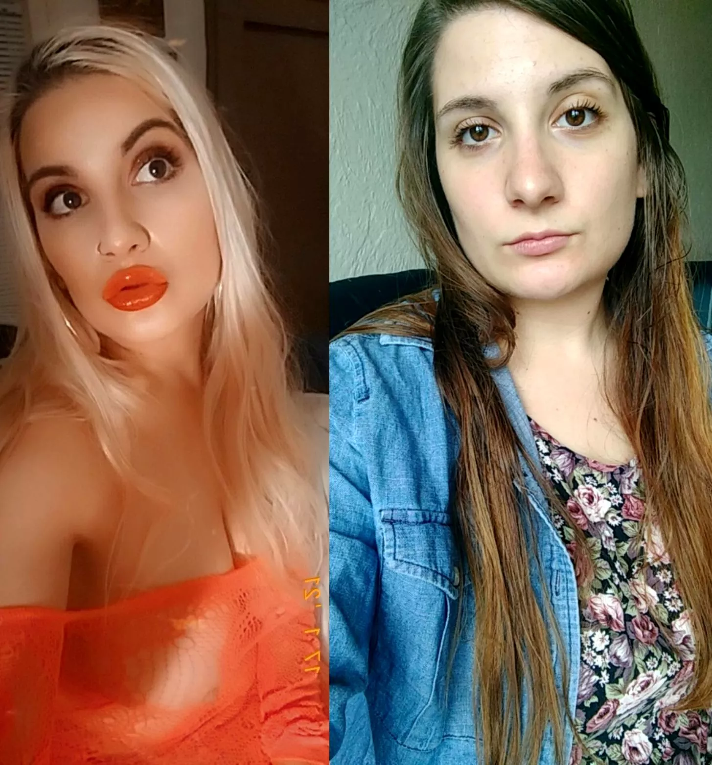 Just got my secnod syringe of filler in my lips and botox! Reflecting on my progress and tiny lips ‚