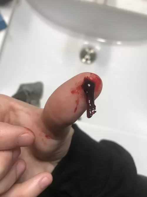 Just pulled from my nose. What is this ?