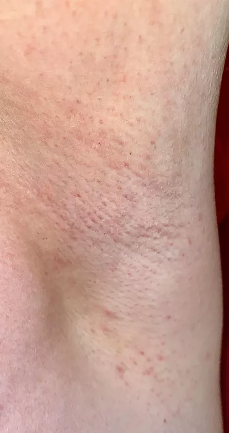 Just shaved for the second time today and I hope my armpits can survive that ๐คฃ