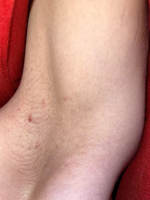 Just shaved. Who likes girls keeping their armpits smooth in the winter? 😬