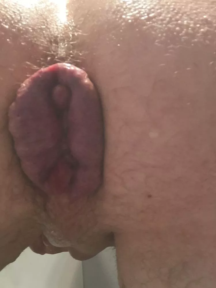 Just taken a rough fisting