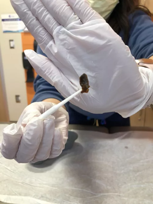 Kid had this pulled out today, sorry no video