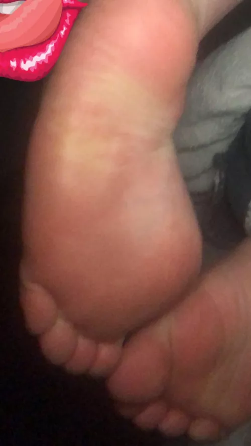 Kiss them