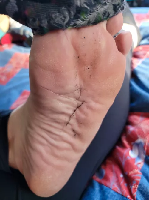 Lint trails