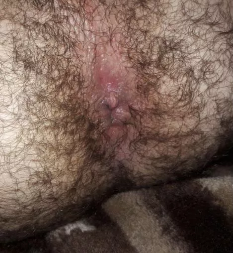 Looking for other hairy smelly dudes who can appreciate my musky hairy butthole Looking for other hairy smelly dudes who can appreciate my musky hairy butthole