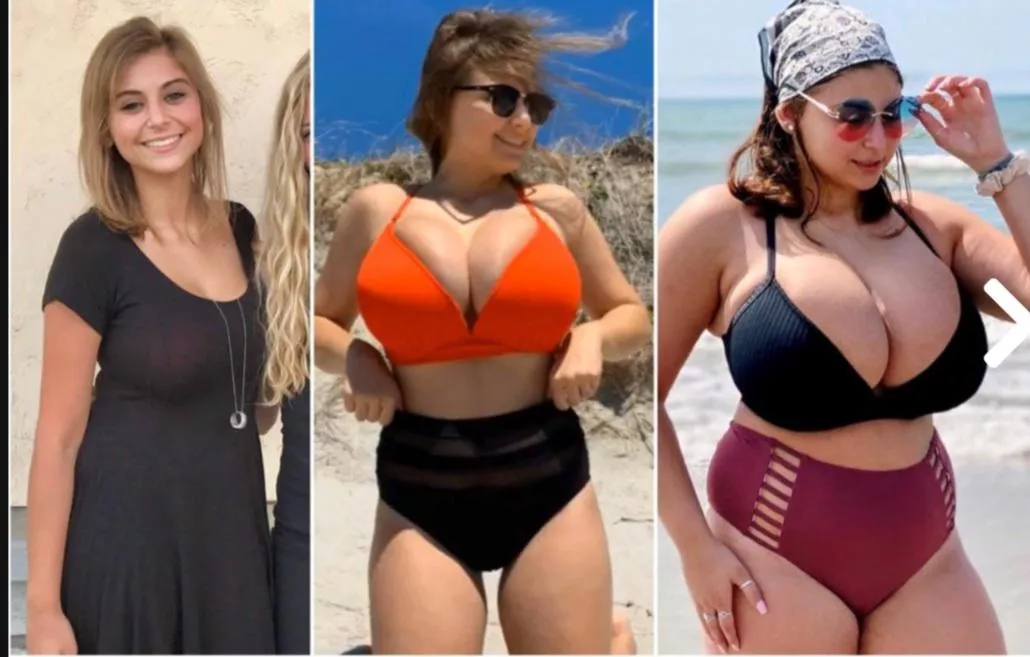 Massive transformation