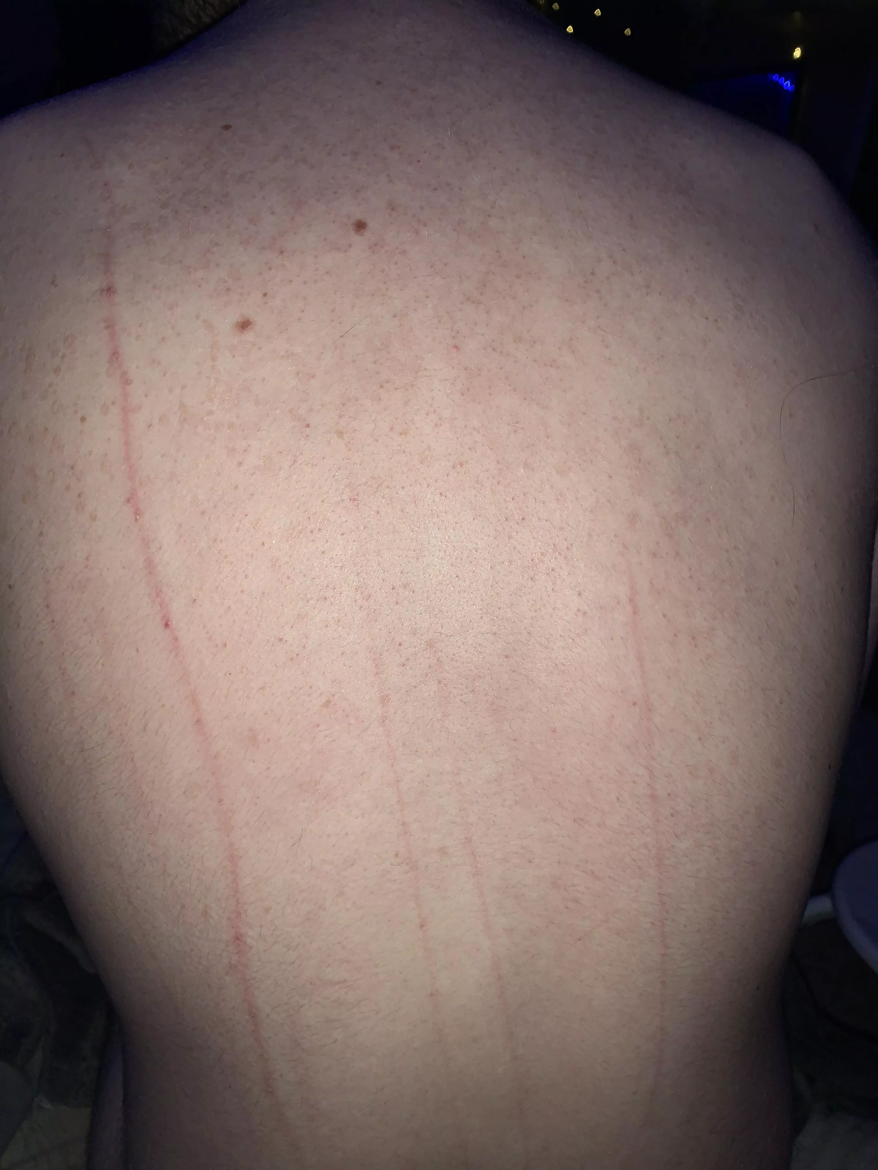 Master didn’t draw blood 😣 maybe they’ll grant me it next time