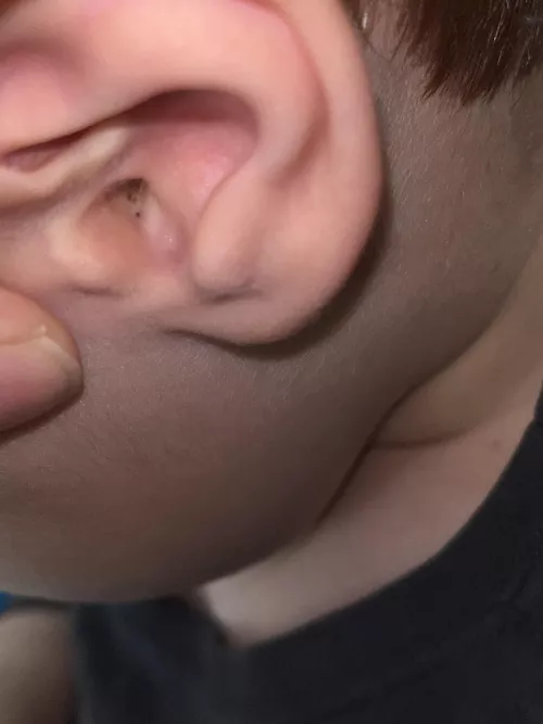 My 5 year old’s left ear is taunting me…
