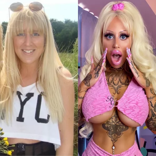 My Bimbofictaion. Next up: expander bresat implants