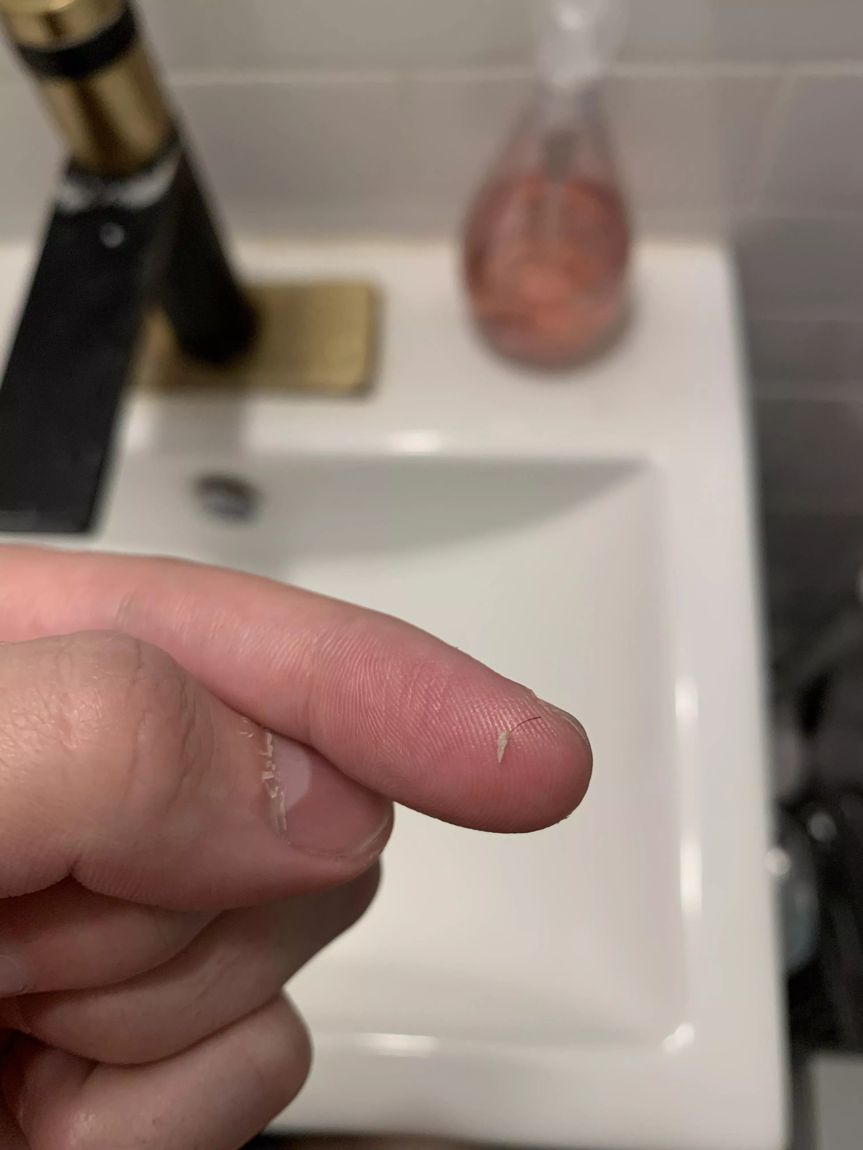 My default is cystic acne, so it’s nice to get some hairy pops once in a while!