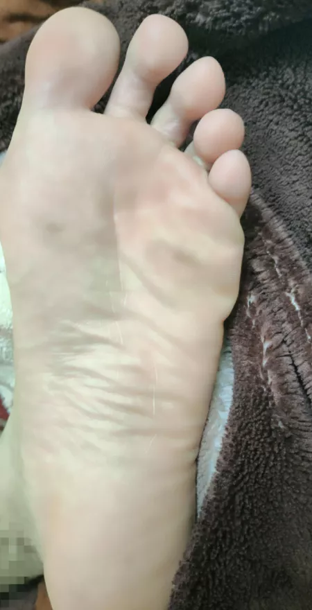 My feet need some care π€
