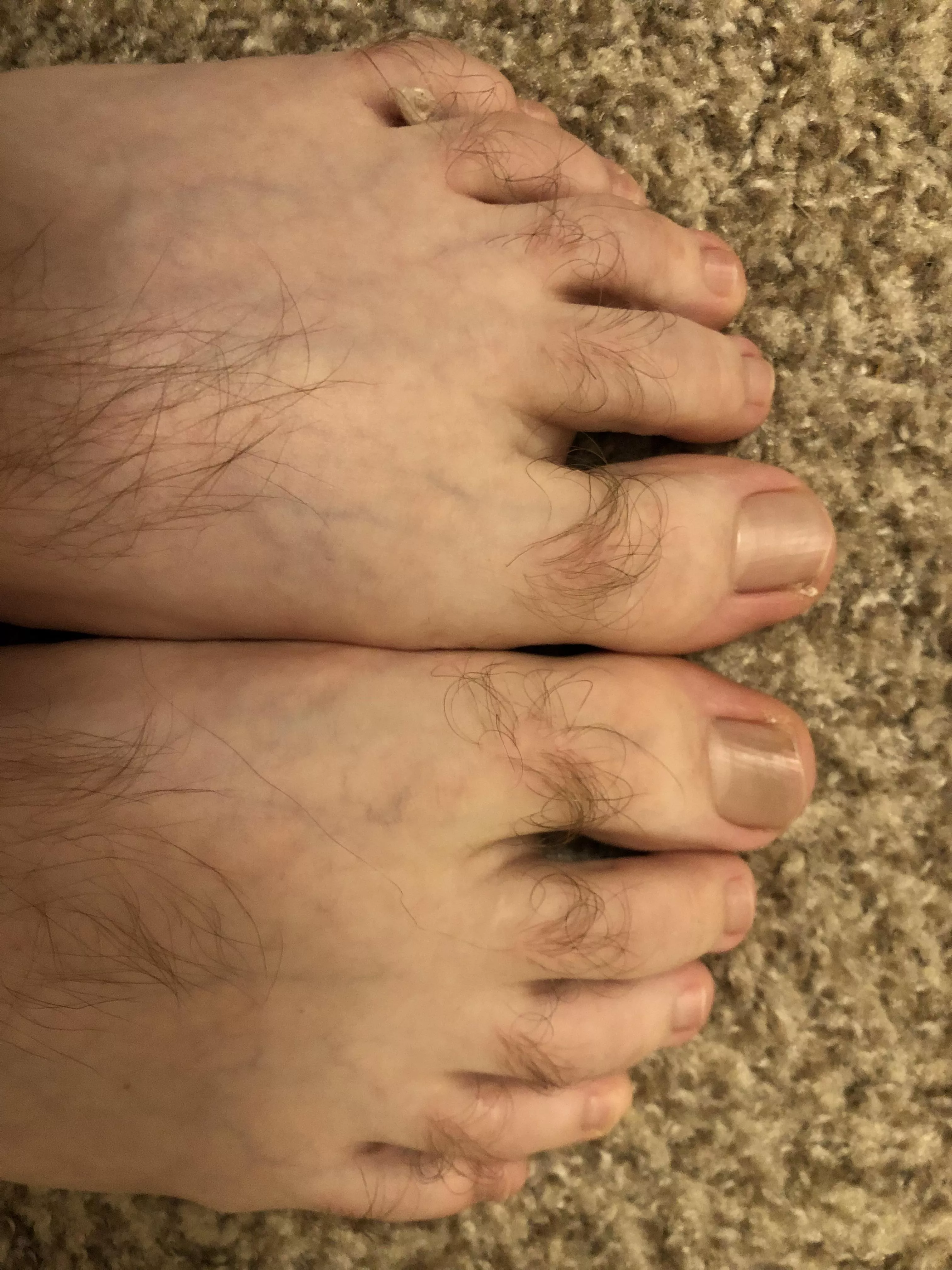 My hairy feet 🦶