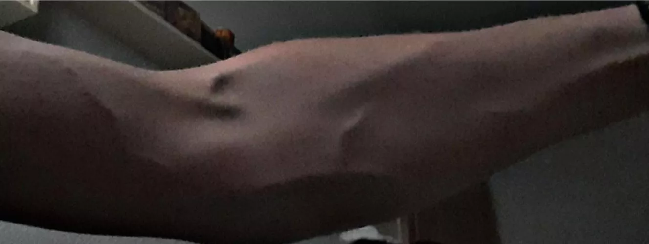 My hot skinny arms 😋