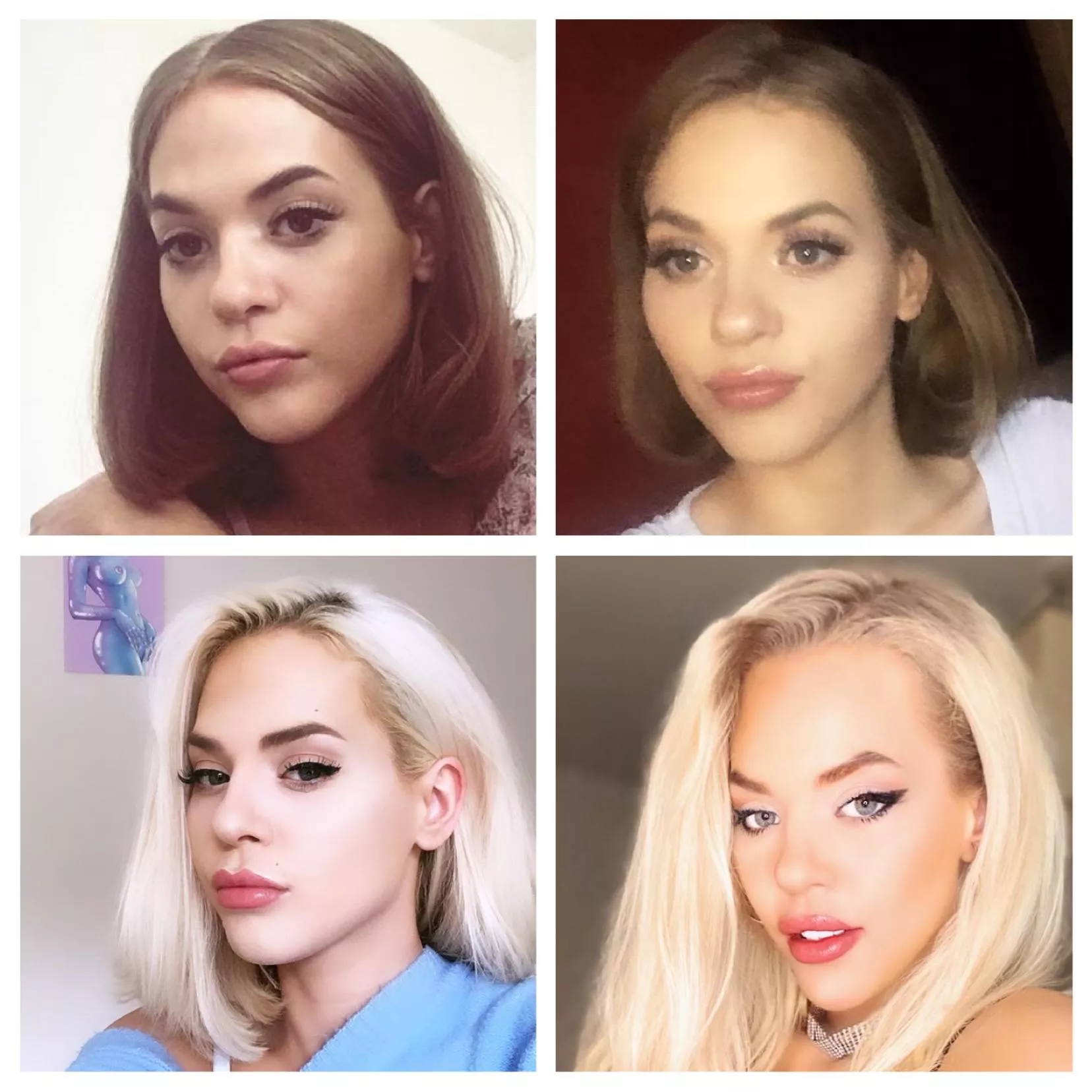 My journey so far ovre the past 3 years(please ignroe my quarantine roots) ; m trying to save for breast implants, a nose job & eyebrow thread lift. If you want to help me fund these, let me know, I want the surgeries as soon as I can and would be su My journey so far ovre the past 3 years(please ignroe my quarantine roots) ; m trying to save for breast implants, a nose job & eyebrow thread lift. If you want to help me fund these, let me know, I want the surgeries as soon as I can and would be su