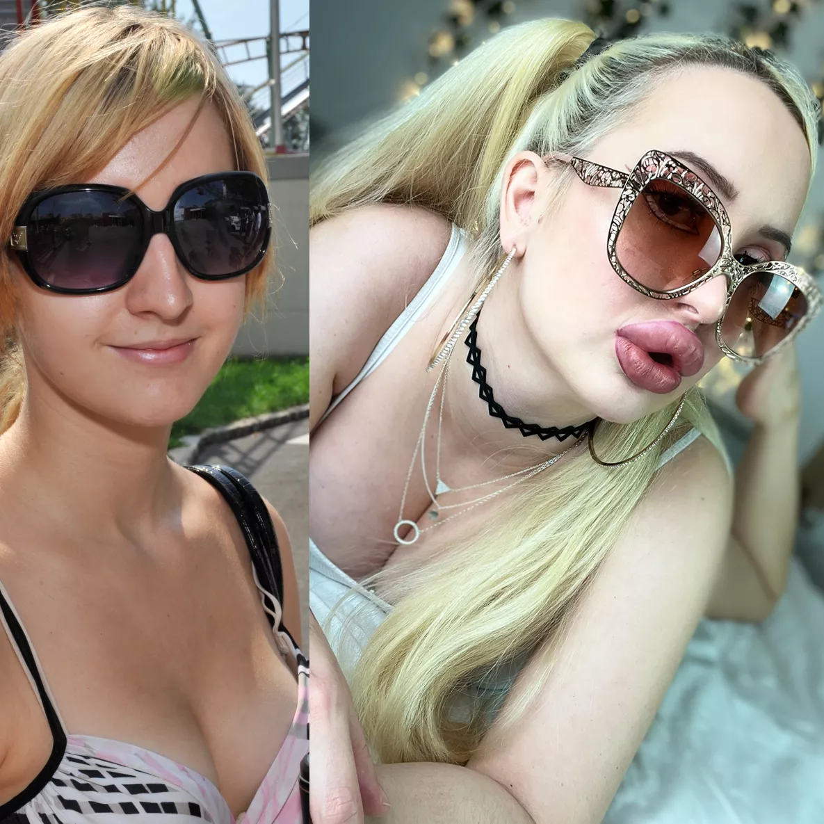 My progress so far. Finally getting breast expanders in February 🥰